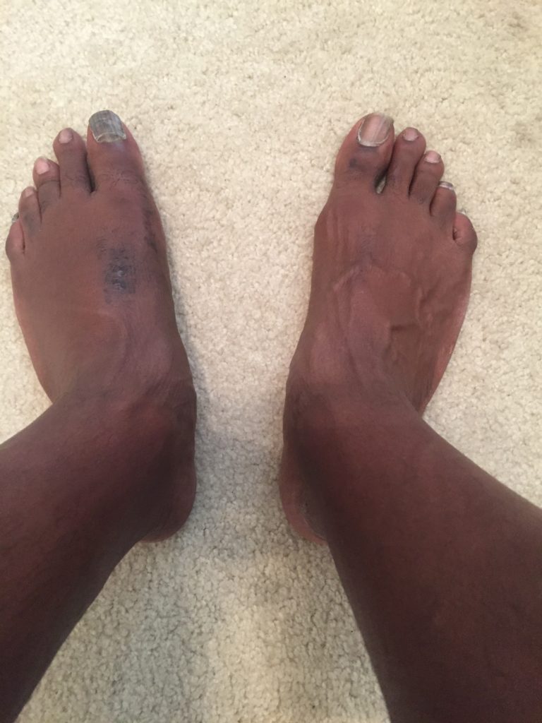 Ugly Feet Pictures 97